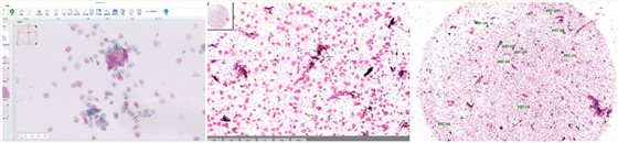 人工智能病理扫描辅助诊断系统