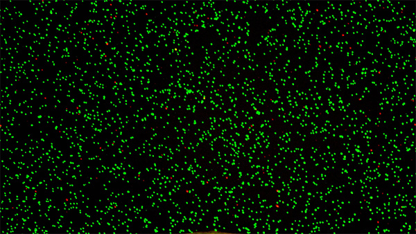 免疫细胞浓度接近9×10E6的荧光实拍图